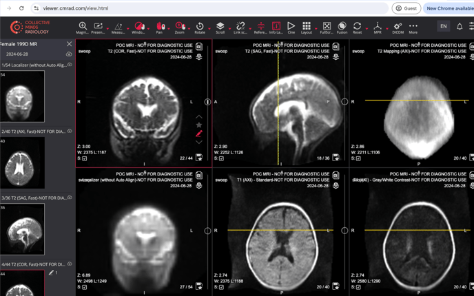 Education-DICOM