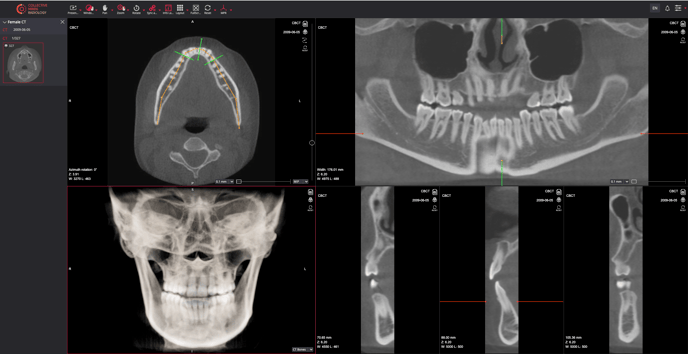 dental